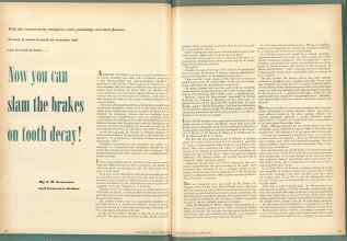 Better Homes & Gardens December 1948 Magazine Article: Now you can slam the brakes on tooth decay!