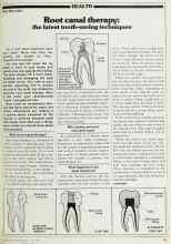 Better Homes & Gardens June 1980 Magazine Article: Root canal therapy: the latest tooth-saving techniques